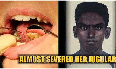 PJ Man Comes In For Root Canal, Then Slashes Dentist And Robs Her After - WORLD OF BUZZ 2