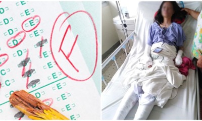 Teacher Makes Girl do Experiment to Pass Exams but She Gets Severely Burnt Instead - WORLD OF BUZZ