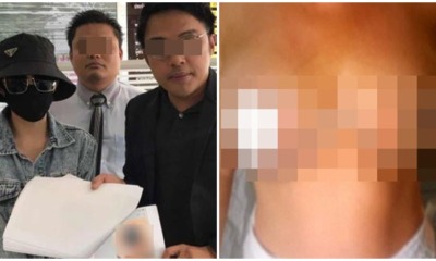 Woman Pays RM9,590 For Breast Surgery That Made Her Lose Her Nipples - WORLD OF BUZZ