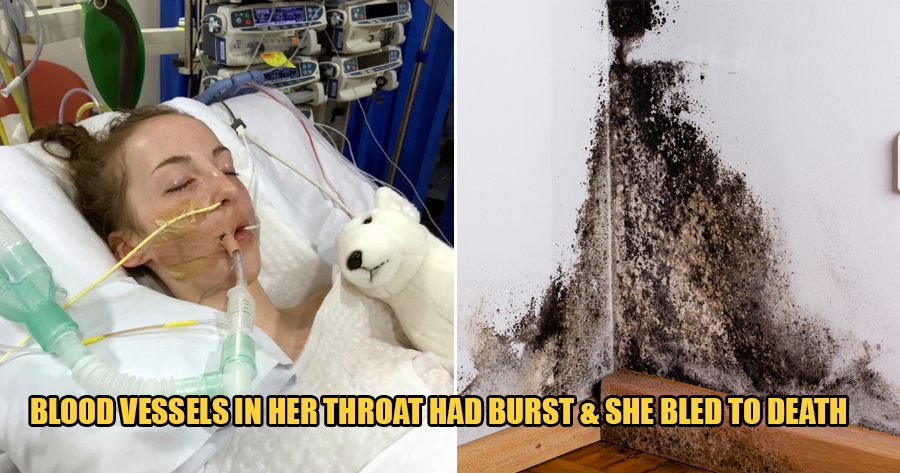 14yo Dies After Breathing in Spores From Mould Which Ate Away the Inside of Her Throat - WORLD OF BUZZ 1