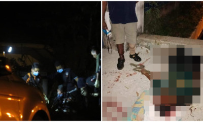 30yo Negeri Sembilan Woman Dies After Sustaining SEVERE Head Injuries From Snatch Theft - WORLD OF BUZZ 4