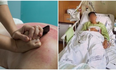 36yo Man Suffers From A Sudden Stroke After Going For Gua Sha Massage Treatment - WORLD OF BUZZ 4