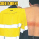 40yo Suffers First-Degree Burns On His Back After Reflective Strip on Shirt Becomes Too Hot - WORLD OF BUZZ