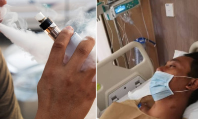 34yo M'sian Man Has Fluid-Like Fungus in His Lungs After Switching to Vape for 2 Weeks - WORLD OF BUZZ