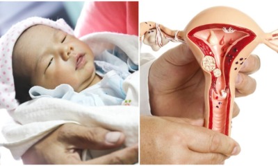 Baby Girl Gets Her PERIOD Just Five Days After She's Born! Shocked Mother Was Told It Was Neonatal Menstruation - WORLD OF BUZZ 4