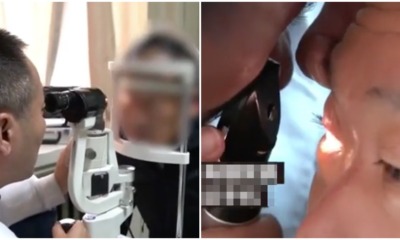 Man Suffers From Eye Stroke Because He Played With His Phone In The Dark Every Night Before Going To Bed - WORLD OF BUZZ 4