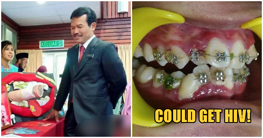MOH: Using Fake Braces Puts You At Risk of Contracting HIV & Other Diseases - WORLD OF BUZZ
