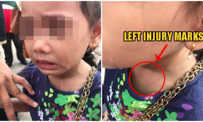 Penang Toddler Gets Her Necklace RIPPED From Her Neck At Open-Air Market - WORLD OF BUZZ