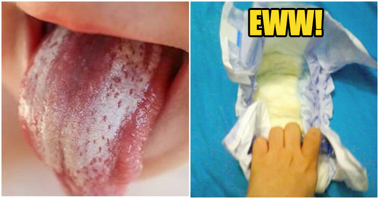 'Petua' Rubbing Baby's Tongue With Pee To Clean It Is Denied By Doctor - WORLD OF BUZZ 2