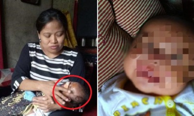 1-Month-Old Baby's Face Bitten By Huge Rat While Sleeping, Suffers Deep Wounds & Needs Stitches - WORLD OF BUZZ