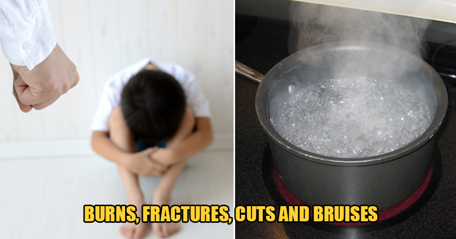 5yo Who Was Severely Tortured by Parents Dies After They Kept Pouring Scalding Water on Him - WORLD OF BUZZ