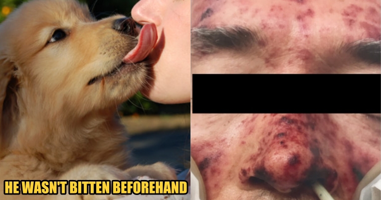 63yo Man Suffered Multiple Organ Failures and Died After His Pet Dog Licked Him - WORLD OF BUZZ 4