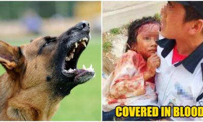 7 yr old girl critically wounded by dog - WORLD OF BUZZ 2