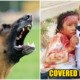 7 yr old girl critically wounded by dog - WORLD OF BUZZ 2
