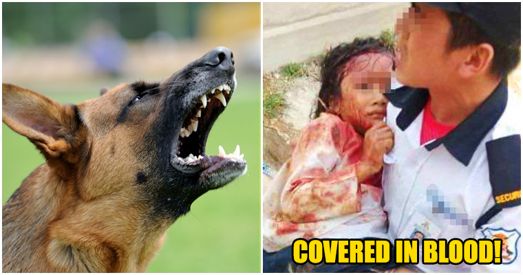 7 yr old girl critically wounded by dog - WORLD OF BUZZ 2