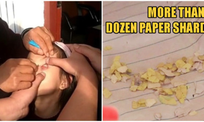 7yo Girl May Lose Her Sight After 3 Boys Bullied Her By Stuffing Paper Scraps Into Her Eye - WORLD OF BUZZ 3