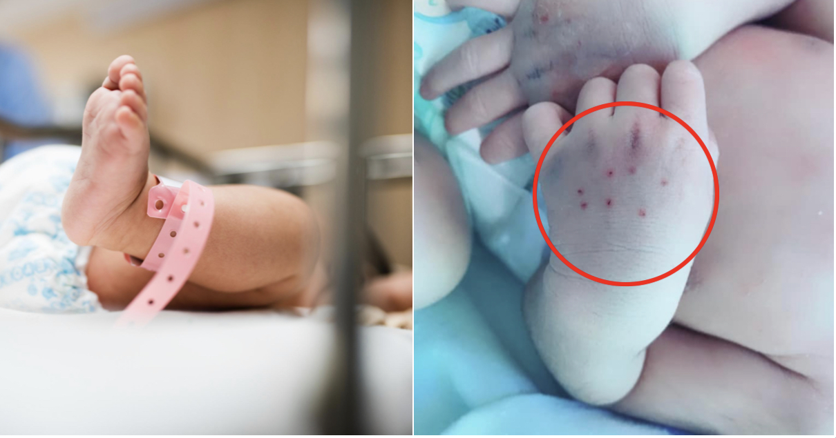 Baby’s Hands Suffered Bruises From 10 Jabs Done By Trainee Doctor To Draw Blood - WORLD OF BUZZ 3