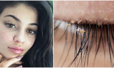 Beware: Doctors Warn Lash Lice Are Becoming More Common In Eyelash Extensions - WORLD OF BUZZ 2