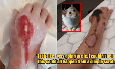 Deep Cat Scratch Turned Into a Deadly Flesh-Eating Disease Which Almost Kills 65yo Woman - WORLD OF BUZZ