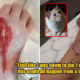 Deep Cat Scratch Turned Into a Deadly Flesh-Eating Disease Which Almost Kills 65yo Woman - WORLD OF BUZZ