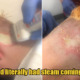 20yo Woman Suffered Third Degree Chemical Burns After Bleaching Her Own Hair to Save Money - WORLD OF BUZZ