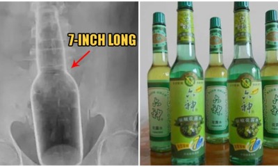 Man Gets 7-Inch Bottle Stuck Up His Rectum After He Tried 'Scratching His Ass' With It - WORLD OF BUZZ 1