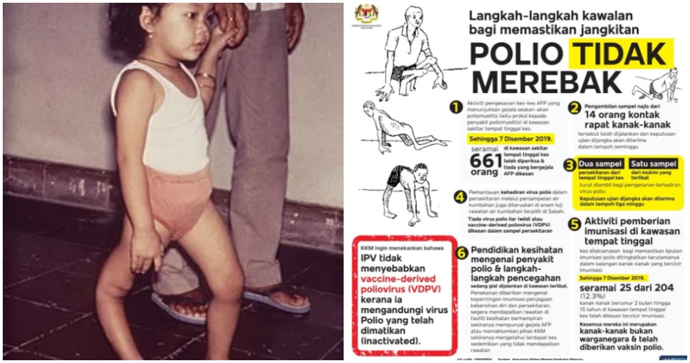 MOH: Controlling Measures Are Being Taken To Avoid The Spreading Of The Polio Infection - WORLD OF BUZZ