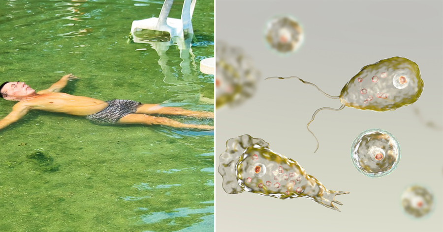 Old Man Almost Dies After Brain-Eating Bacteria Entered His Nose at Hot Springs - WORLD OF BUZZ