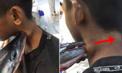 Teenager Gets Stabbed in The Neck By Swordfish While Fishing With His Paren - WORLD OF BUZZ