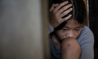 5 Year Old Boy in Terengganu With Broken Cheekbone, Believed to Have Been Abused at Home - WORLD OF BUZZ 2