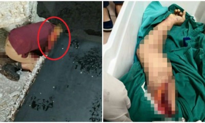 51yo Penang Man's Arm Gets Horrifically Ripped Off While Moving Heavy Machinery At Paper Mill - WORLD OF BUZZ 4