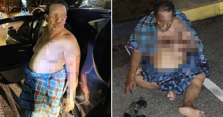 67yo M'sian at Mosque Suffers Severe Burns After Masked Man Splashes Kerosene & Sets Him On Fire - WORLD OF BUZZ 4