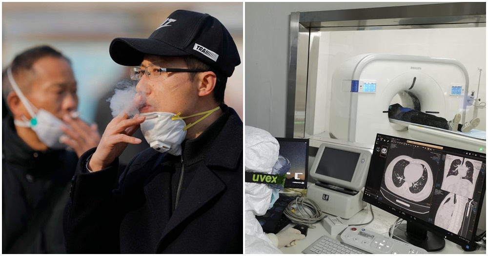Medical Experts: Smokers At Higher Risk Of Suffering Severely From Coronavirus - WORLD OF BUZZ 3