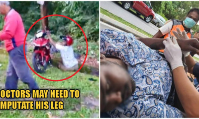 Selayang Snatch Thief Gets Instant Karma, Loses His Leg After Snatching Woman's Handbag - WORLD OF BUZZ 3