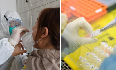 Suspected Coronavirus Patients Can Now Be Diagnosed Within 15 min - WORLD OF BUZZ