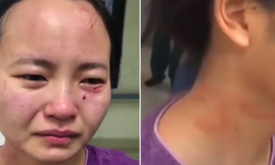 Nurse in Isolation Ward Gets Assaulted & Bitten On Face by Covid-19 Patient Who Refused To Cooperate - WORLD OF BUZZ