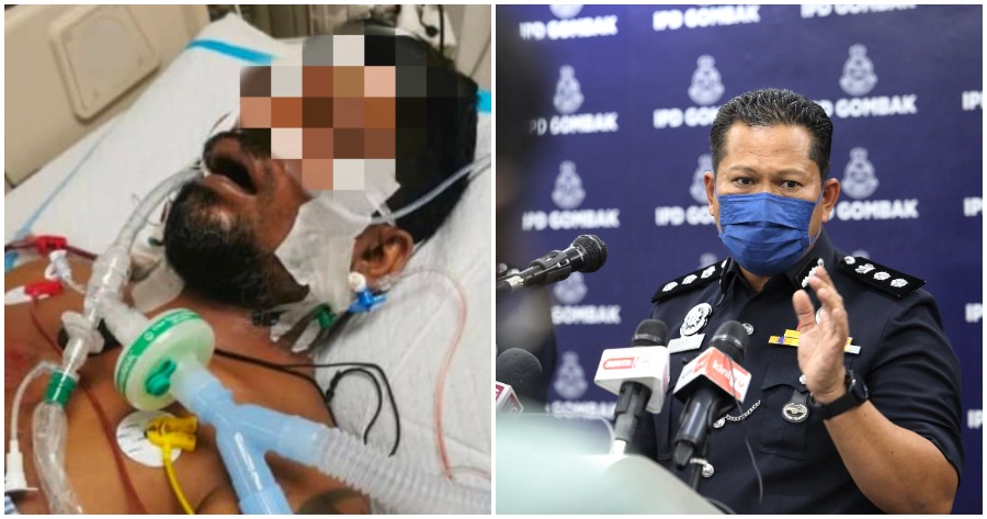 aim in icu