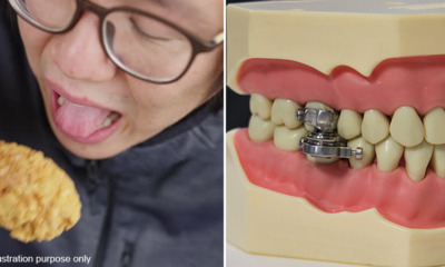 Magnetic device for weight loss