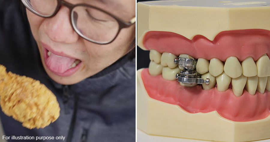 Magnetic device for weight loss