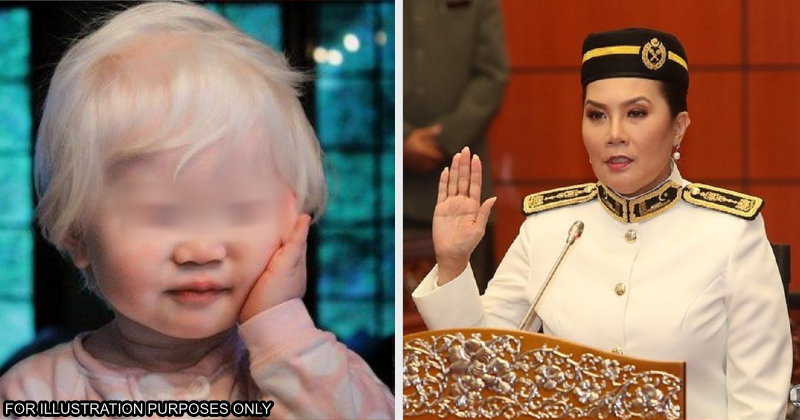 includealbisiminokulist