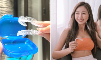 WOB Zenyum braces feat 2