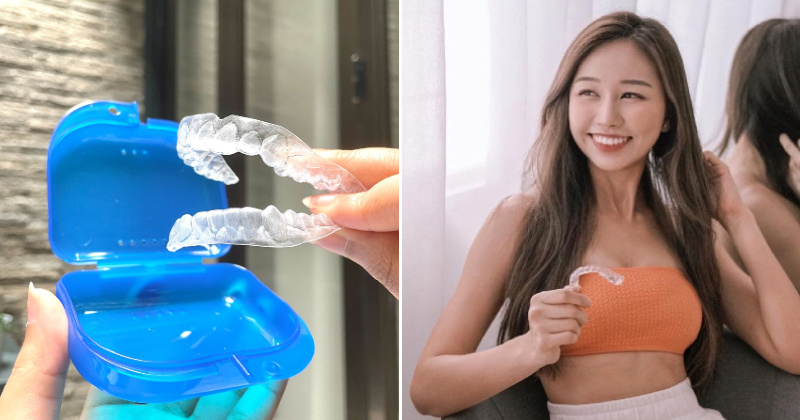 WOB Zenyum braces feat 2