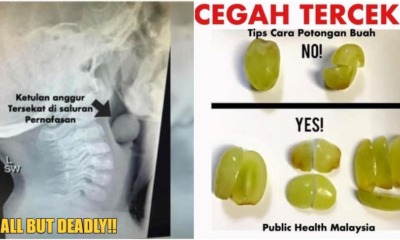 FT image grape choke