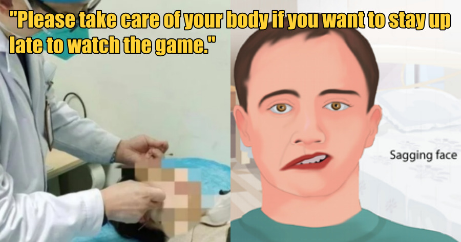 facial palsy ft