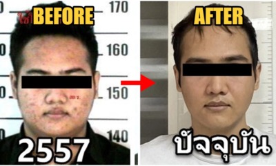 drug lord plastic surgery 1