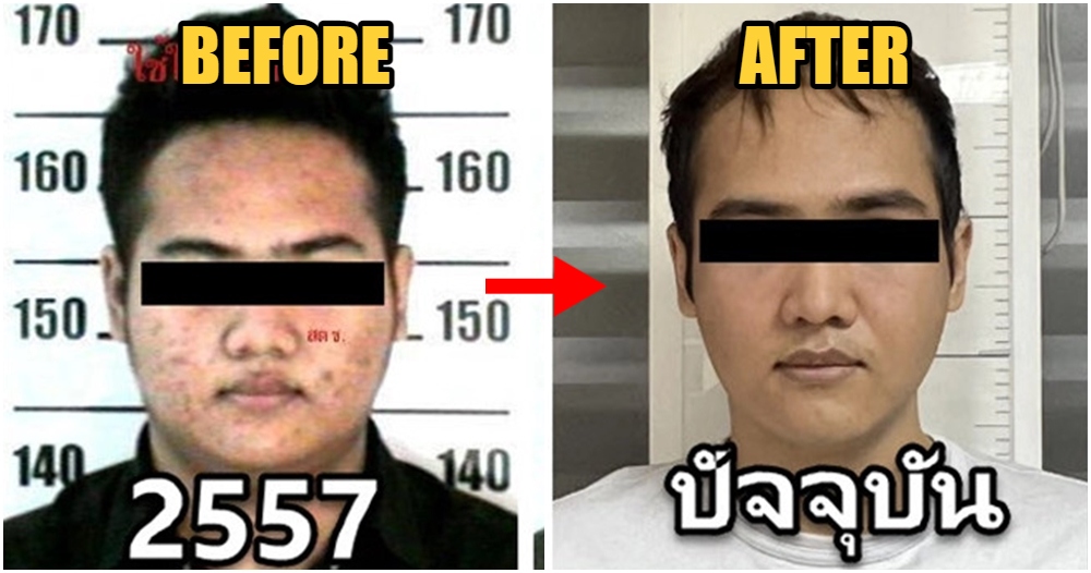 drug lord plastic surgery 1