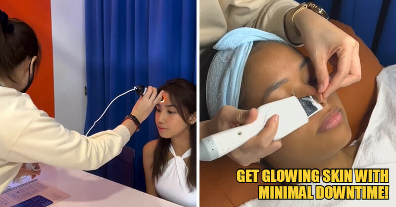 WOB CleanSlate feat 3A