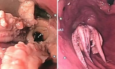 feat image octopus stuck