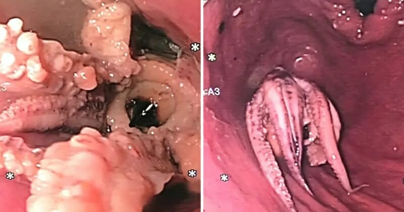 feat image octopus stuck