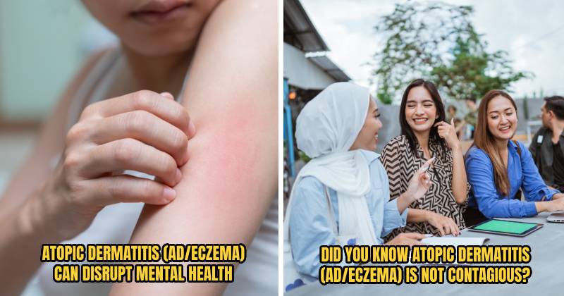 SanofiEczema Header 4